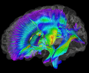 Image: A visualization of white matter pathways in the brains of infants at-risk for autism. Warmer colors represent levels of white matter organization and development (Photo courtesy of Jason Wolff).